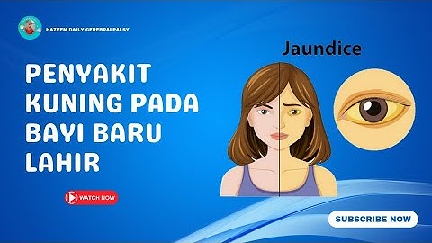 PENYAKIT KUNING PADA BAYI BARU LAHIR | NEWBORN JAUNDICE
