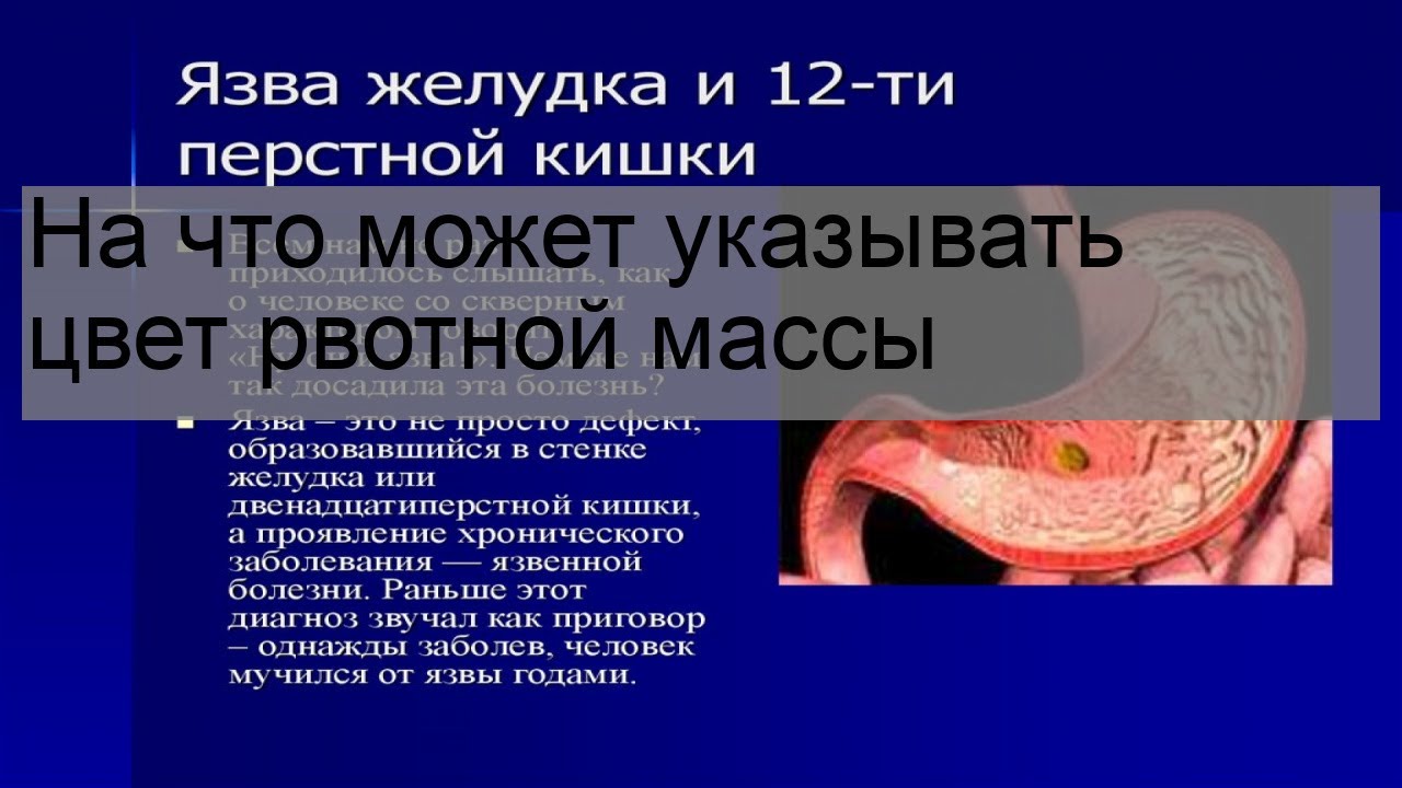 На что может указывать цвет рвотной массы