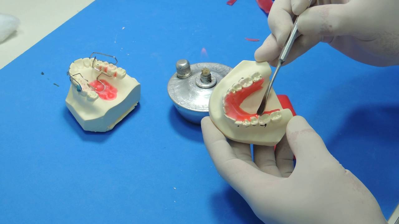 Bionator - Alívios com cera