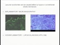 Neurological Manifestations of Lupus and Other Systemic Rheumatologic Disorders
