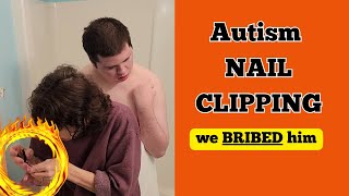 NO!  Not the FINGERNAIL CLIPPERS!  Autism SENSORY OVERLOAD.