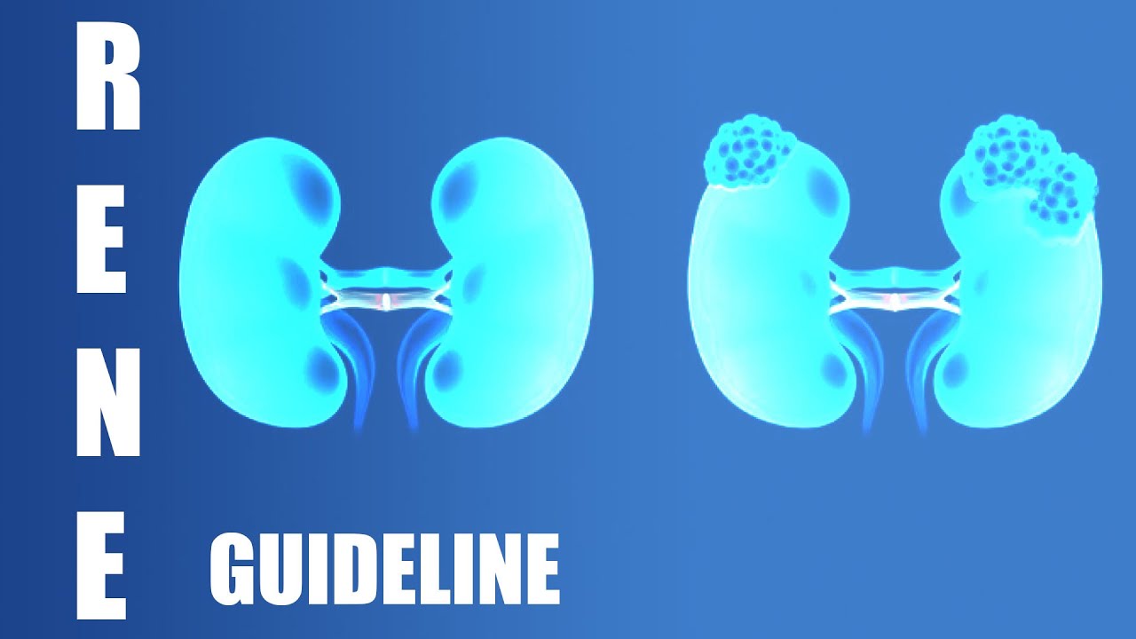 Curare il Tumore del Rene - Linee Guida 2025