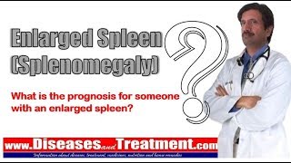 Enlarged Spleen (Splenomegaly): What is the prognosis for someone with an enlarged spleen?