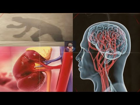 هرمون الأدرينالين