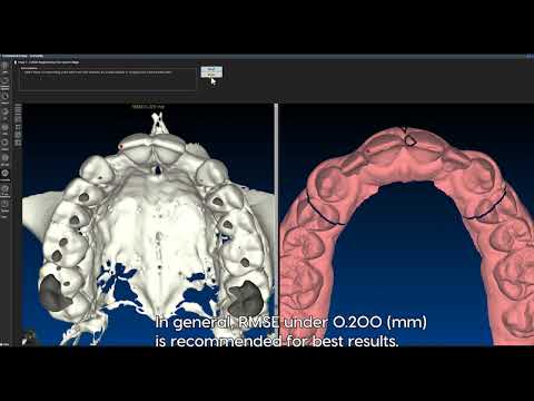 In2guide Total Implant Solution