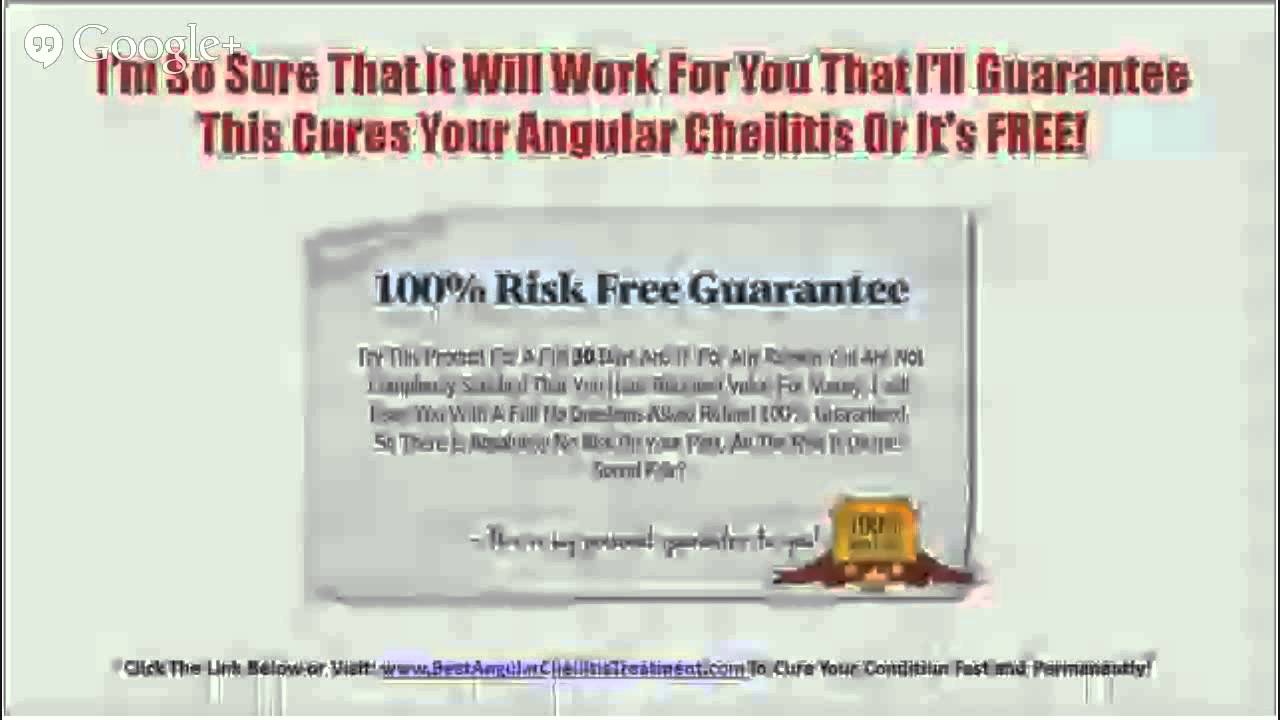 Angular Cheilitis Mayo Natural Angular Cheilitis Treatment YouTube