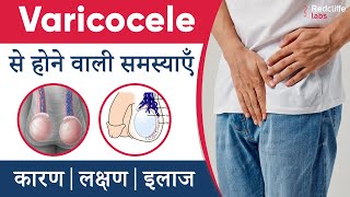 Varicocele से होने वाली समस्याएँ और इलाज | ✅#Varicocele Symptoms, Causes And Treatment in Hindi screenshot 1