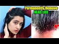 बालों की जूं कैसे हटाऐं | Permanent Removal of Hair Lice in 1 Week |