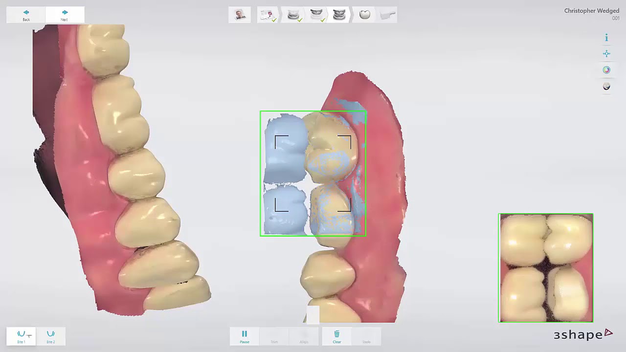 video phone beyonce mp3 3Shape TRIOS Design Studio - Fluxo de trabalho para coroas