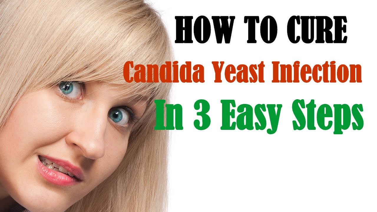 How To Treat Candida Yeast Infection In 3 Easy Steps Vitalife Show