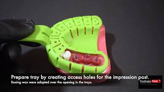 Impression Techniques for Implant Dentistry Step by Step Splinted open tray Impression technique