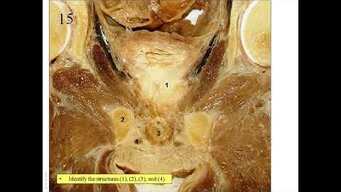 OSPE in Anatomy of Endocrine and Reproductive Systems