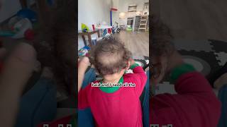 Baby bald spots - I am not a fan 🤣 #baby #bald Baby bald spots - I am not a fan 🤣 #baby #bald