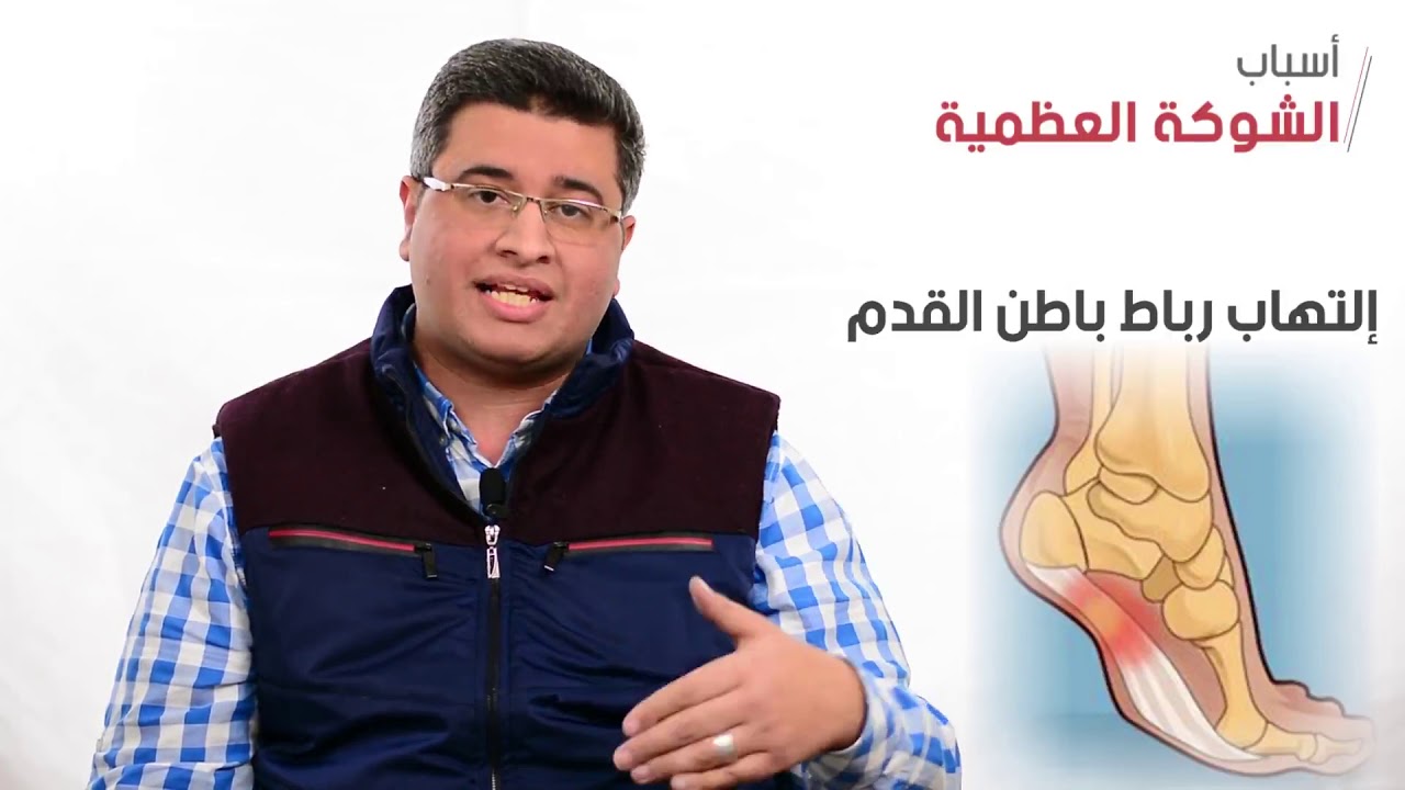 د. كريم صلاح - الشوكه العظمية