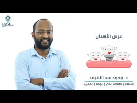 غرس الاسنان مع د محمد عبد اللطيف دكتور أسنان بالدقي