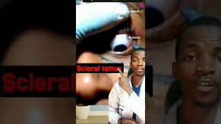 Illar yin tattoo a Ido #Hausa #Arewa #Kano #HausaHealth