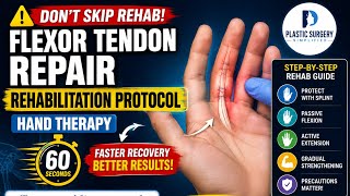 Flexor tendon rehabilitation protocol | Hand therapy in 60 seconds #plastic #physiotherapy 