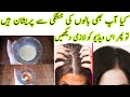 Balon se khushki khtam krne tariqa||How To Get Rid Of Dandruff Flakes