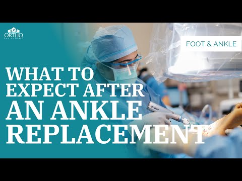 Ankle Replacement Surgery #recovery