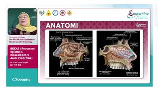 REKAS (Recurrent Epistaxis Kiesselbach's Area Syndrom) 