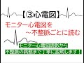 ③心電図～モニター心電図を不整脈ごとに読む(循環器医が不整脈の病態から1つ1つ解説します)