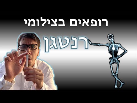 רופאים בצילום רנטגן