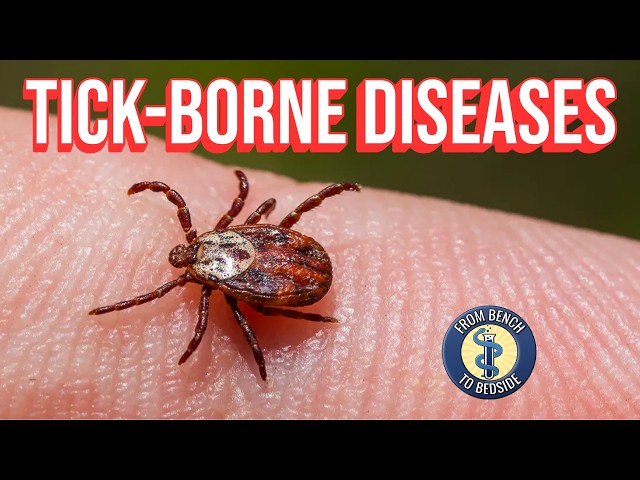 Ticked Off: What You Need to Know About Tick-Borne Diseases - YouTube