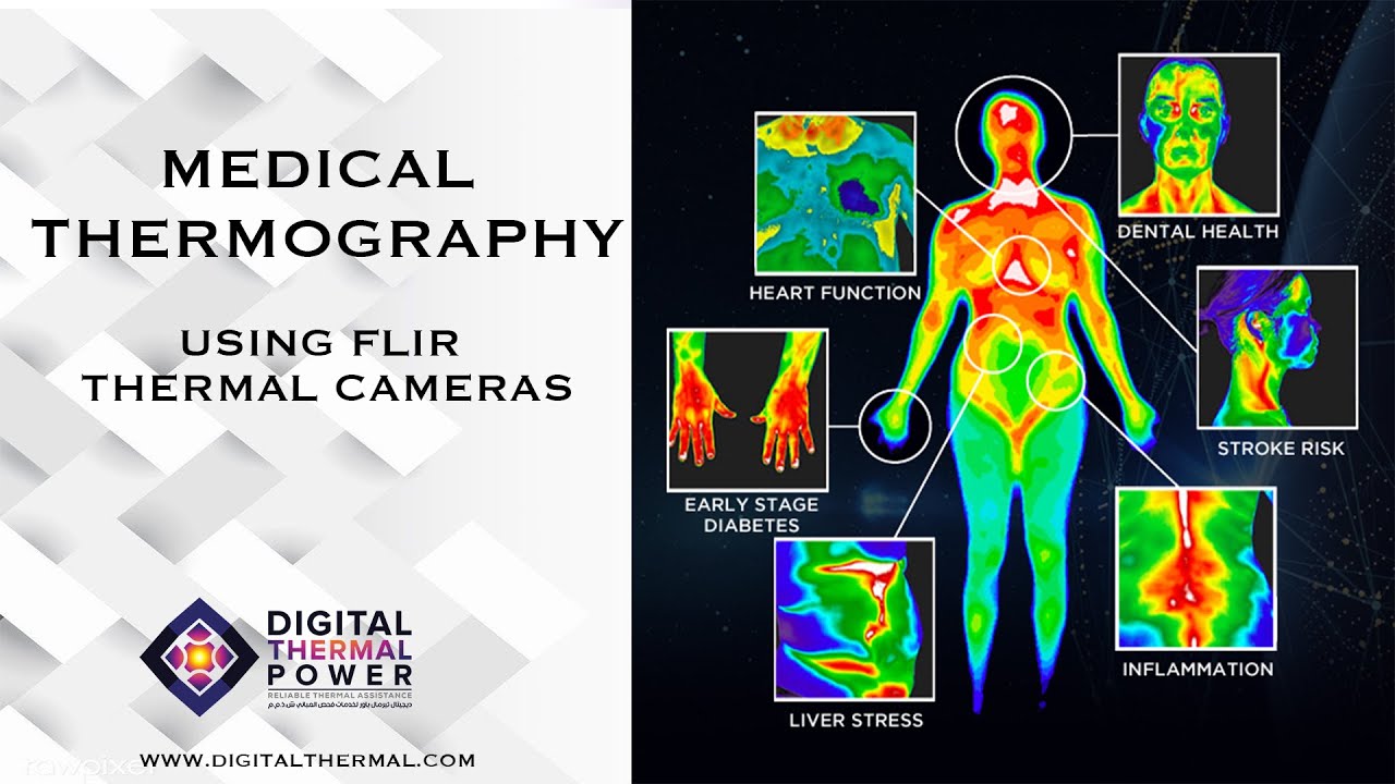Medical Thermography using FLIR Thermal Camera YouTube
