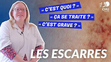 C'est quoi un escarre ?