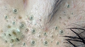 𝘼𝙘𝙝𝙞𝙚𝙫𝙚 𝙄𝙣𝙣𝙚𝙧 𝙋𝙚𝙖𝙘𝙚 𝙬𝙞𝙩𝙝 𝙏𝙝𝙚𝙨𝙚 𝙁𝙖𝙘𝙞𝙖𝙡 𝘾𝙡𝙚𝙖𝙣𝙨𝙞𝙣𝙜 𝙈𝙚𝙩𝙝�