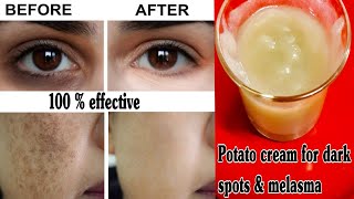 DIY Potato cream for pigmentation, Melasma|how to Remove dark spots| Dark spots removal on face