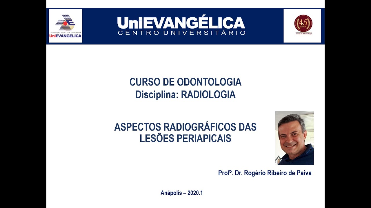 AULA 01 - ASPECTOS RADIOGRÁFICOS DAS LESÕES PERIAPICAIS / PROF. ROGÉRIO PAIVA