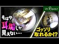 これは自分じゃ無理!!やればやるほど奥へ… ear wax removal
