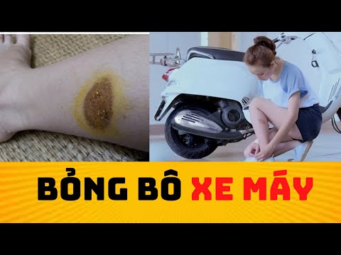 Video Bỏng Bô Xe Máy | Trị Bỏng Bô Xe Máy Nhanh Lành, Không... - youtube