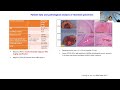 Stratification of HCC Towards Precision Medicine
