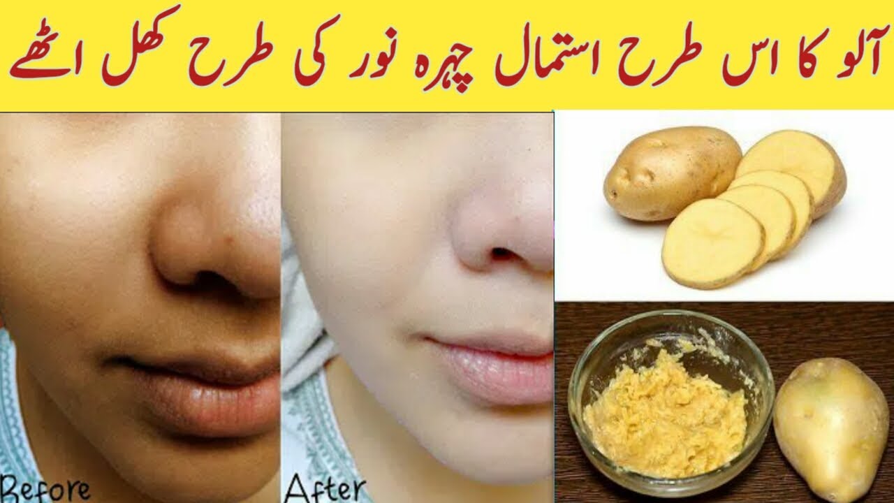 Potato facial/ potato face mask for dark spots/ Potato face whitening