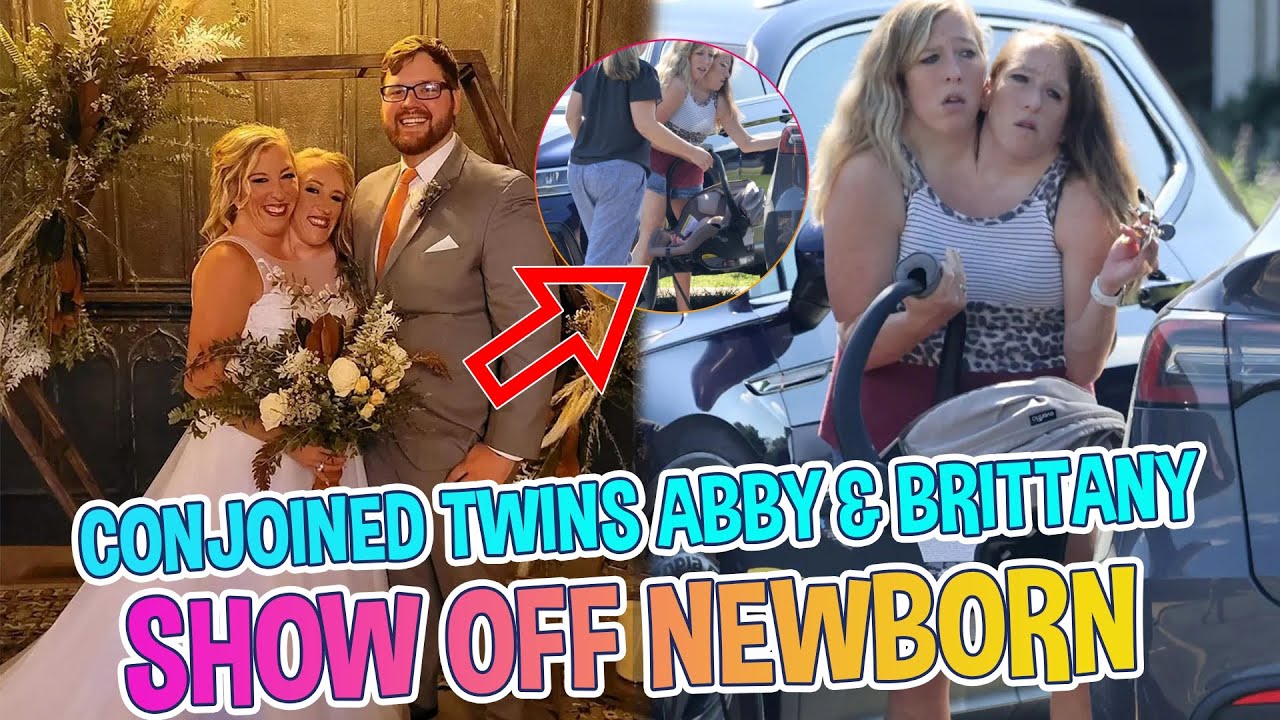 Conjoined Twins Abby and Brittany Proudly Debut Newborn Weeks After Baby Rumors!