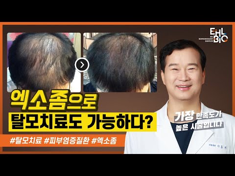 Can exosomes really help hair loss and inflammatory skin disease?