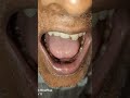 tongue#tongue#mouth #health #oralhealth #teeth #dental #shorts #facts #doctor