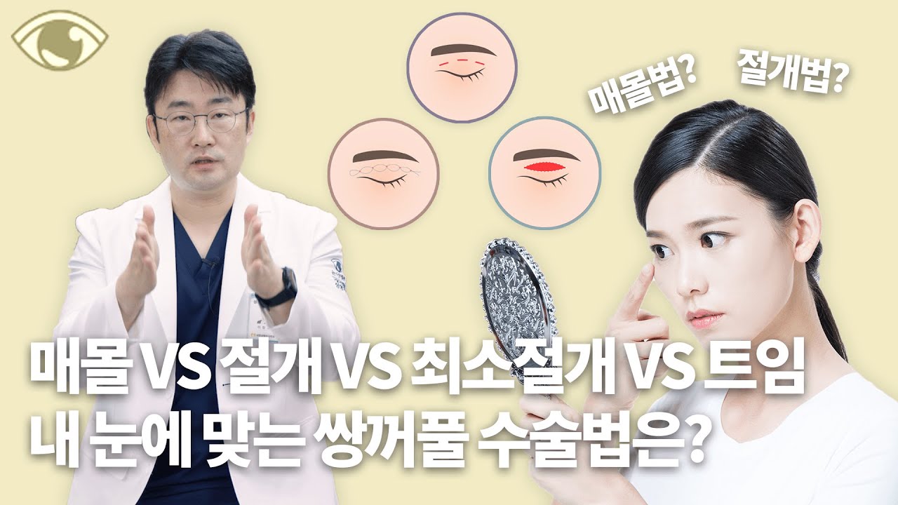 매몰법, 절개법, 최소절개, 트임... 눈 유형별로 쌍수 방법이 달라집니다!_[부산 케이엔젤성형외과]