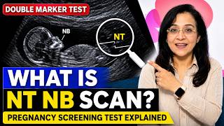 What is NT NB Scan? Pregnancy Screening Test Explained | Double Marker Test