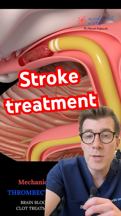 Doctor explains STROKE TREATMENT - clot removal #shorts