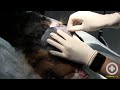 Treating a Canine's Head Abscess Part 1: Prep, Drain, Flush