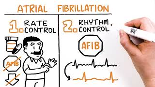 Treatment Options for AFib
