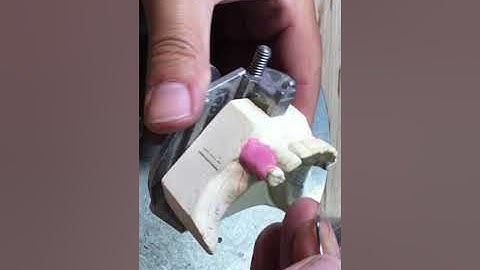 DENT 1158 Project #1 Survey/Design/Blockout