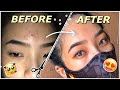 5 STEPS FOR CLEAR SKIN (BYE PIMPLES!) +SHOUTOUTS