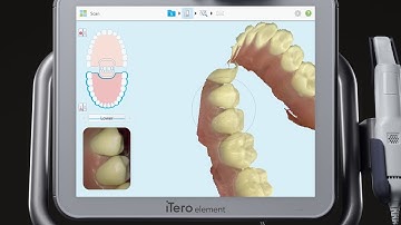 iTero® Scanner Tutorial: Using the Multi-Bite Function