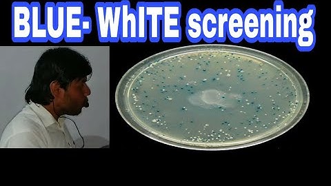 Screening part G (Blue-white screening) rDNA technology lecture 5