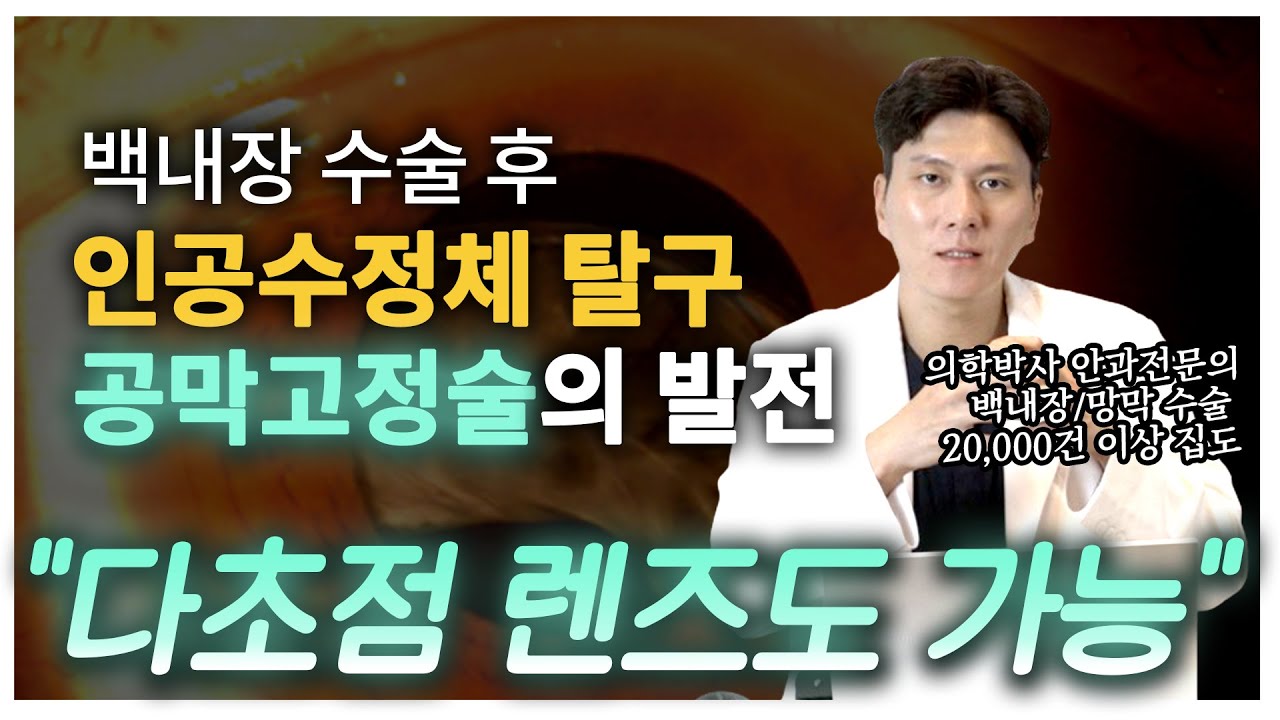 [Сонгможин Нүдний Эмнэлэг] Катарактын мэс заслын дараа зохиомол болор мултрах! Склера бэхлэх мэс засал. Одоо олон фокусын линз ч хэрэглэх боломжтой. [Анагаах ухааны доктор Пак Жинхён, Ерөнхий эмч]