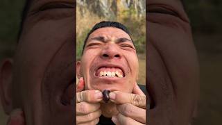 How I Cured a Bug Bite with Yogurt in the Wild | Survival Hacks🤯😫😅